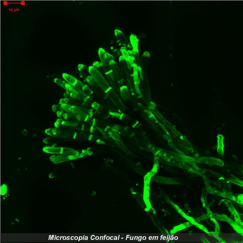 9. confocal fungo.png